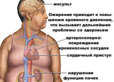 Расплата за ожирение неизбежна